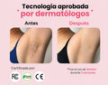 Depildaroa IPL Profesional