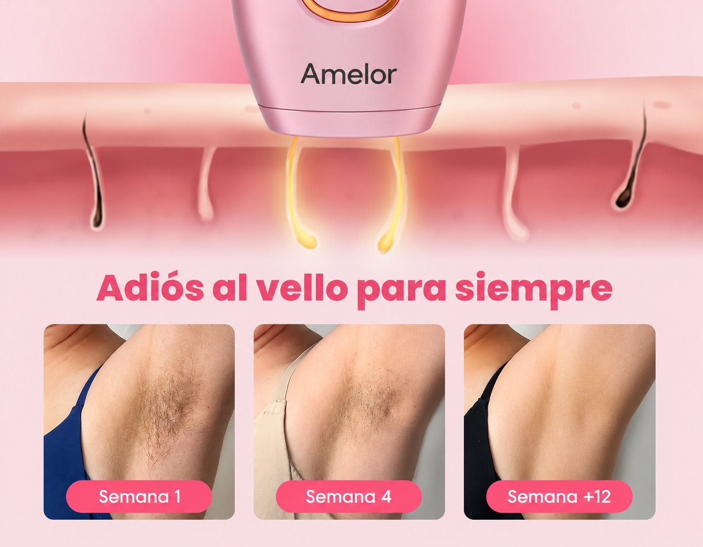 Depildaroa IPL Profesional
